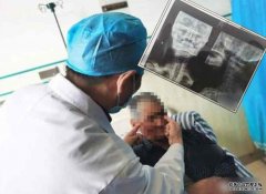 沐鸣总代理10厘米长断刃插头26年 七旬老翁奇蹟存活