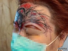 沐鸣招商主管额头纹白莲惊变第三隻眼 女客轰店家乱画：很想死