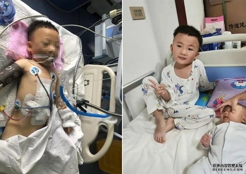 沐鸣软件下载4岁奇迹男孩 28楼堕下重伤1个月后已能站立