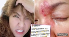 「生蛇」反遭诅咒　沐鸣安卓版APP下载黎瑞恩嬲爆跟网民骂战