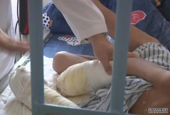 7岁男童双手被烧沐鸣招商主管伤现烟头疤痕 疑遭父亲虐待恐需截肢