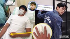 晒卧牀照被游学修嘲沐鸣平台挂机软件下载扮嘢　刘俊谦夹爆中指送院缝3针