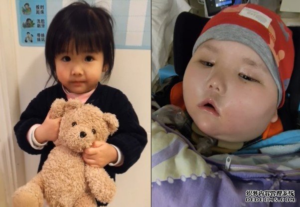 6岁小天瑜第4年沐鸣登录留院过圣诞 家人感谢网民祝福