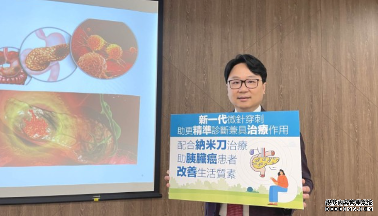 醫療資訊|逾八成胰臟癌屬中後期 新一代微針穿刺提高準確度沐鸣平台官网